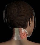 Zone 1 Sub-Occipital Zone